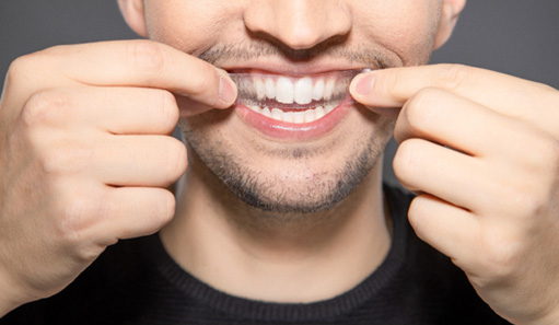 Patient in Oshkosh using teeth whitening strips